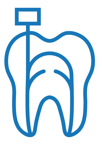 Root Canal Treatment 